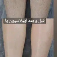 سالن زیبایی بیوتی آرتمیس|خدمات آرایشگری و زیبایی|اهواز, بهارستان|دیوار