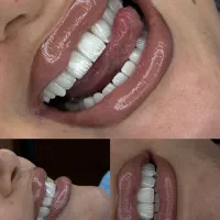 لبخندی درخشان و سلامت دندان‌های شما، اولویت ماست.
