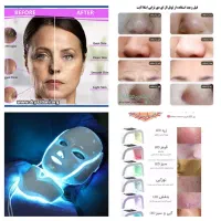 ملکه زیبایی