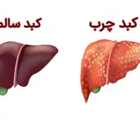 پکیج درمان کبد چرب