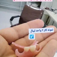 دندان مصنوعی  ( تمام چک )|آرایشی، بهداشتی، درمانی|پارس‌آباد, |دیوار