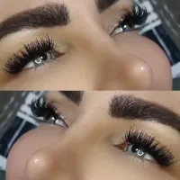 کاشت مژه آتی بدون ریزش