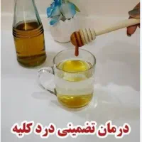 درمان سنگ کلیه