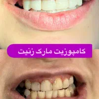 دندانپزشکی با پرداخت یک سوم هزینه|خدمات آرایشگری و زیبایی|سقز, |دیوار