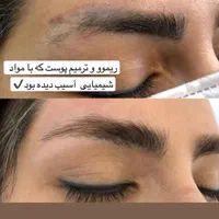 ریموتتوروشن کردن نواحی تیره درمان لک|خدمات آرایشگری و زیبایی|قم, باجک دو|دیوار