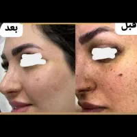 کرم سفید کننده و ضد لک ضد پیری رفع چروک جوش پوست|آرایشی، بهداشتی، درمانی|تهران, کامرانیه|دیوار