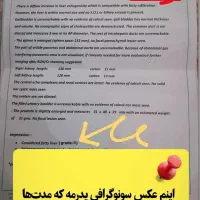 اگه درگیر کبد چرب هستی پیام بده|آرایشی، بهداشتی، درمانی|امامزاده عبدالله, |دیوار