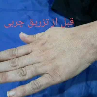 خدمات لیزر و زیبایی