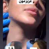 جشنواره انجام زاویه فک وگونه بابهترین برندکره ای