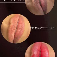 خدمات ارایش دائم با قیمت مناسب