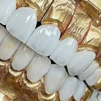 روکش تمام سرامیک ودندان مصنوعی|آرایشی، بهداشتی، درمانی|اندیمشک, |دیوار