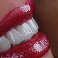 به زیبایی لبخند بزن