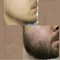 معجزه قرن