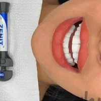 خدمات دندانپزشکی طرح همایتی(نیمه رایگان)|خدمات آرایشگری و زیبایی|کرمانشاه, |دیوار