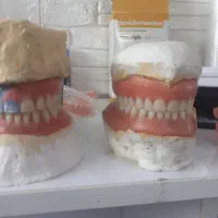 کشیدن دندان و ساخت دندان مصنوعی... در منزل شما