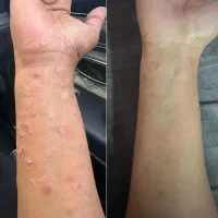 درمان مشکلات پوستی