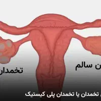 درمان تضمینی وقطعی مشکلات رحم|آرایشی، بهداشتی، درمانی|قم, نیروگاه|دیوار