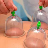 حجامت سنتی مراعات بهداشتی|خدمات آرایشگری و زیبایی|خاش, |دیوار