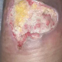 تزریقات وپانسمان در منزل|خدمات آرایشگری و زیبایی|نجفآباد, قدس|دیوار