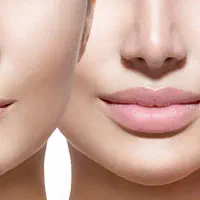 فرمول چاق کننده صورت