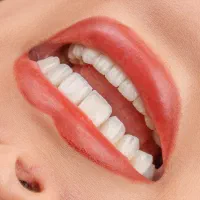 تخفیفات ویژه دندانپزشکی