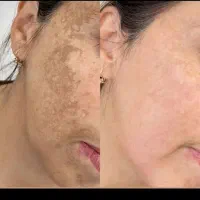 کرم و صابون ژل رویال چاقی ول ا غ ر ی قیمت عالی|آرایشی، بهداشتی، درمانی|دزفول, |دیوار