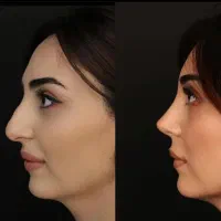بینی طببیعی. پرداخت آسان.کرمانشاه.
