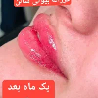 بن مژه از ما هدیه دریافت کن