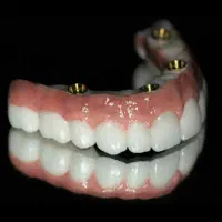 دندانپزشکی اوردنچر دوفک فقط ۱۸۵تومن در تبریز باوام