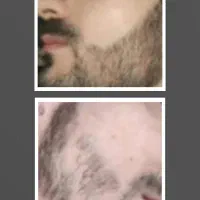 رشد حداکثری ریشات مثل جنگل میشه