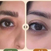 محصول رشد ابروها.جای جوش.ولک