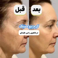 کرم بیوممتیک پوست ضد لک تیرگی روشن کننده اصل