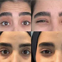 تزریق ژل و بوتاکس هایفو فیلربادی|خدمات آرایشگری و زیبایی|تهران, عبدل‌آباد|دیوار
