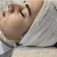 آموزش تخصصی فیشال و پاکسازی پوست|خدمات آموزشی|ارومیه, |دیوار