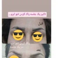 لیزر پاک کردن تتو ابرو و بدن و خالکوبی قدیمی|خدمات آرایشگری و زیبایی|اهواز, اهواز|دیوار