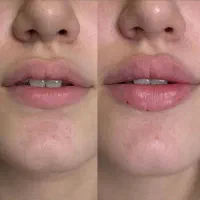 خدمات زیبایی پوست و مو