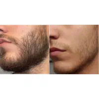 بهترین و برترین روش برای درمان