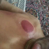 حجامت و بادکشی در منزل|خدمات آرایشگری و زیبایی|بیرجند, |دیوار