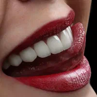 کامپوزیت دندان ، دندانپزشکی شیراز