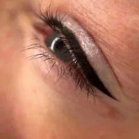 آموزش فیبروز میکرو شید/60درصد تخفیف/مطب زیبایی