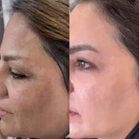 روشن کننده پوست