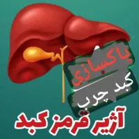 پاکسازی کبدچرب