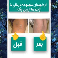 درمان بیماری های پوست|آرایشی، بهداشتی، درمانی|اهواز, فولادشهر|دیوار