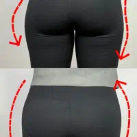 فیلربادی با تخفیف ۵۰٪در کلینیک مهرزاد|خدمات آرایشگری و زیبایی|تهران, جردن|دیوار