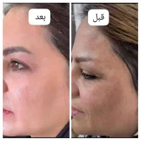 متخصص پوست و موهمراه مشاوره‌  وروتین پیشنهاد محصول|خدمات آرایشگری و زیبایی|اردبیل, |دیوار