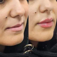 استخدام فوری درمطب