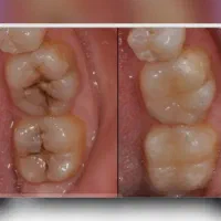 خدمات درمانی و زیبایی دندان|خدمات آرایشگری و زیبایی|کرمانشاه, |دیوار