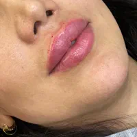 ژل لب،ژل باسن،بوتاکس هایفو نخ،مزو،زاویه سازی صورت|خدمات آرایشگری و زیبایی|شاهین‌شهر, فردوسی|دیوار