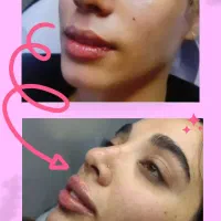تخفیف ویژه کلینیک زیبایی لوکس و مجهز در نسیم شهر|خدمات آرایشگری و زیبایی|نسیم‌شهر, |دیوار