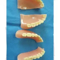 تعمیر دندان مصنوعی شکسته